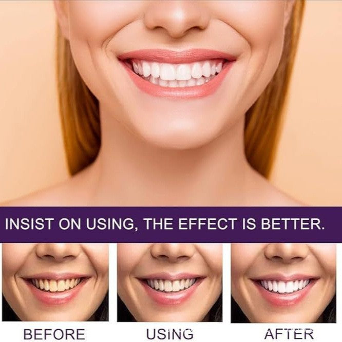 Dentifrice puissant best-seller pour rafraîchir l'haleine